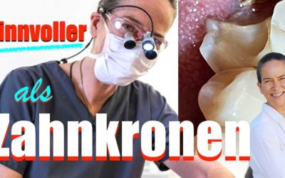 Teilkrone- der Geheimtipp