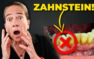 Mach DAS gegen Zahnstein ( für lebenslange eigene Zähne!)